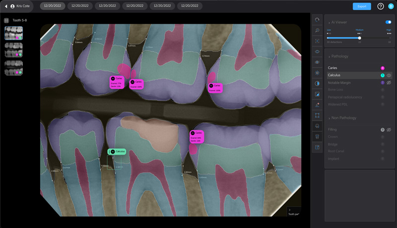 AI Detection and Diagnosis in 