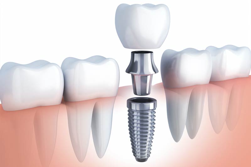 Cone Beam CT Imaging in 