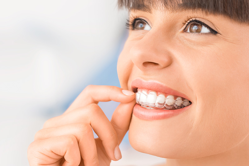 Invisalign in Redondo Beach